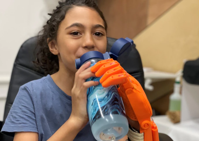 Young amputee embraces 3D-printed hand after lawnmower accident