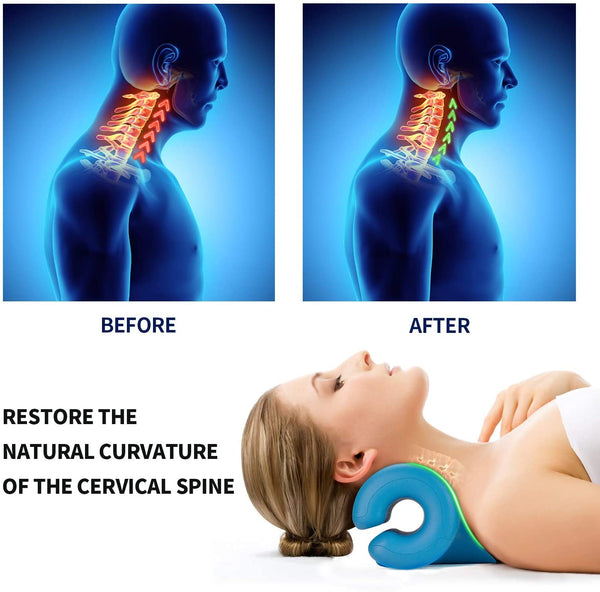 Neck and Shoulder Relaxer - Cervical Traction (8132604821741)